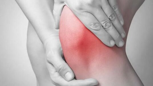 põlveliigese artroos